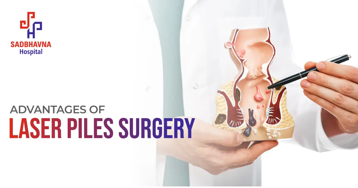 Advantages of Laser Pile Surgery